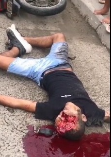 victim had his head cracked open in horrific accident