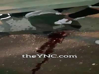 Ã need one new leg