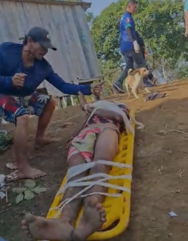 Dude Hacked with Machete Even Stabbed while Being Rescued