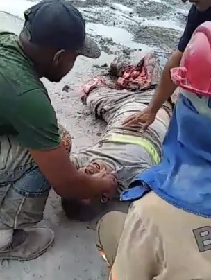 Worker in terrible agony after his legs were crushed