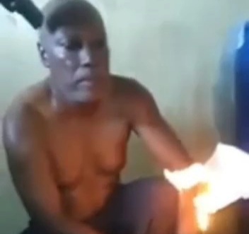 Old Haitian man tortured by melting plastic on his hand 