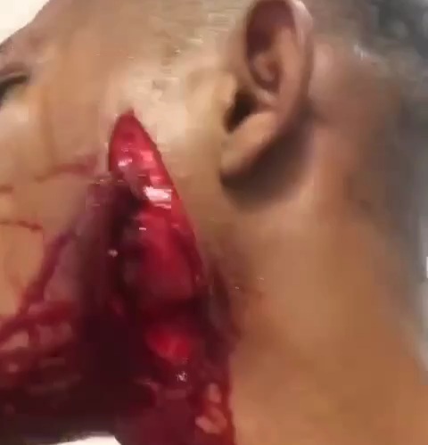 Nigerian man slashed in the face 