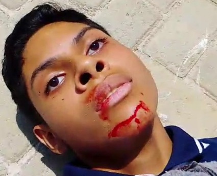 [LAST GASPS OF AIR]15 years old boy fatally stabbed in school