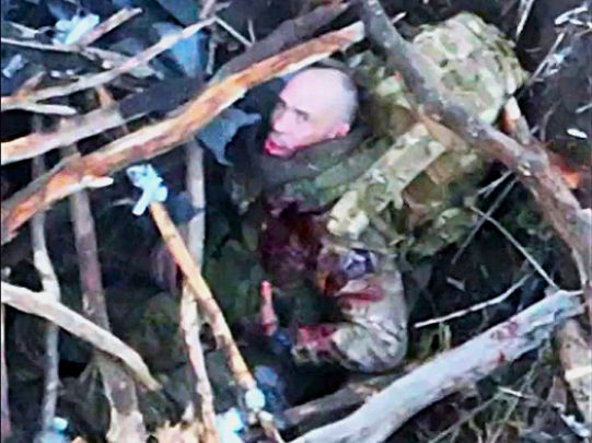 Dying Russian in Agony Symbolizes What's to Come