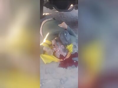 Biker's Head Split Open