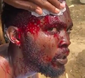 Nigerian man was attacked by angry driver with machete 