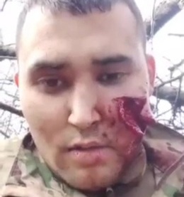 soldier was seriously wounded recorded a video about his condition 