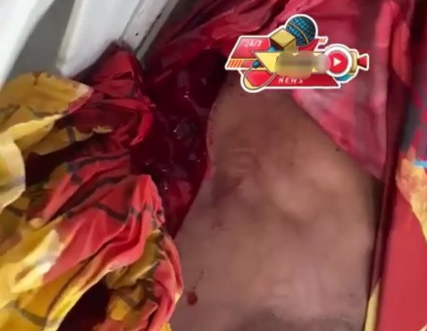 Young man suffer from a horrible machete wound 