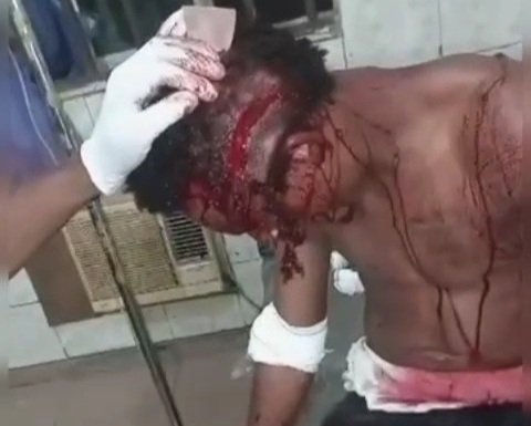 Viking member sliced with a machete hospitalized 