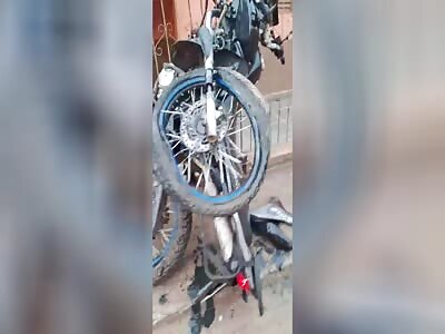 idiot has leg destroyed while walking at speed