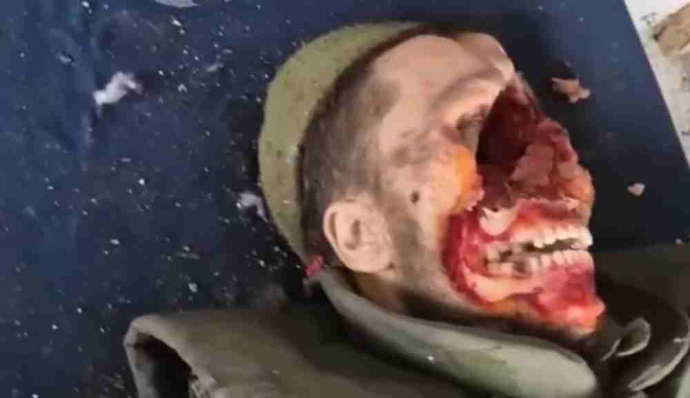 We may need more than a tourniquet.