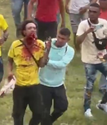 More Aftermath of the Idiot Attacked by the Bull