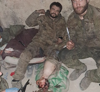 Russian soldier with shattred leg wait for doctors in shelter 