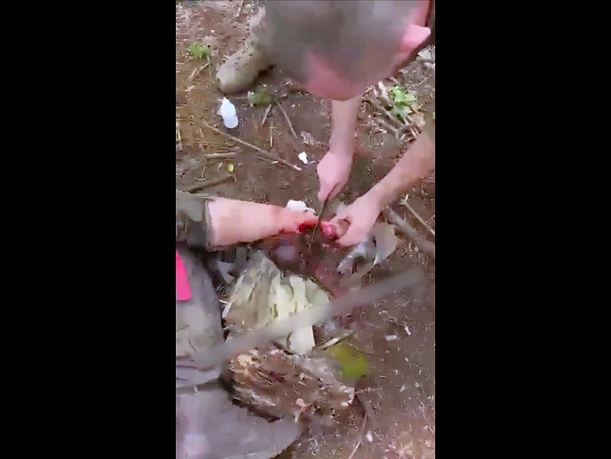 Just a Russkie Sawing Off 'Comrades' Foot...