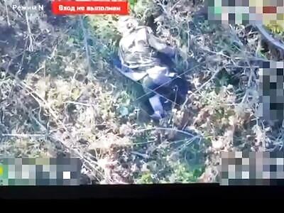 Ukrainian lost both legs but his muscles still work