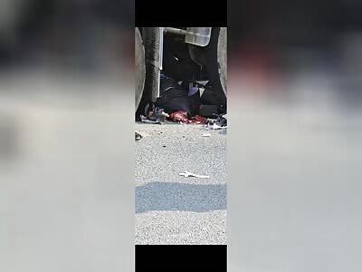 Chinese man's head smashed