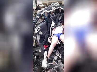 Consequences of a brutal road accident 