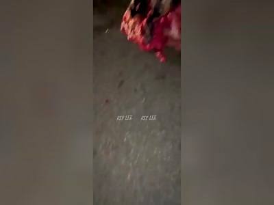 Woman turned into a mountain of flesh 