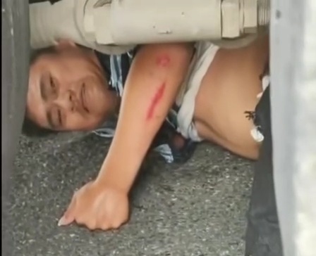 Lucky Motorcyclist had only his both legs crashed under truck wheel 