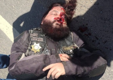 Motorcyclist suffered from a serious injury after crash 