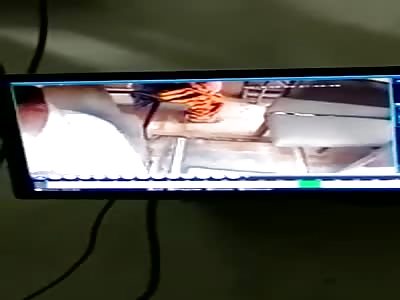 bus driver with blows of machete on the head and neck