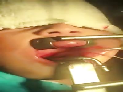 LOL: Thief Chokes Trying to Swallow Earrings...