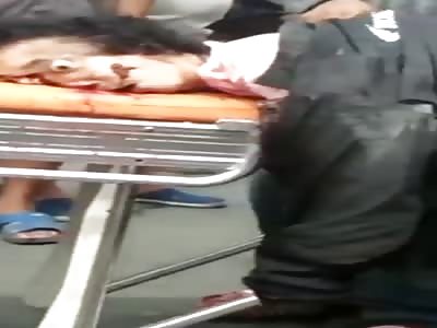 women head shattered after brutal accident