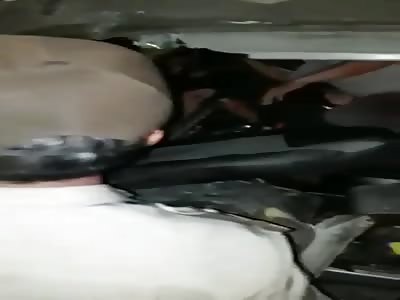 That is one fucked leg.