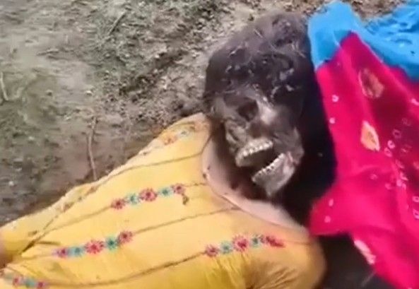 Young Woman's Face Got Eaten