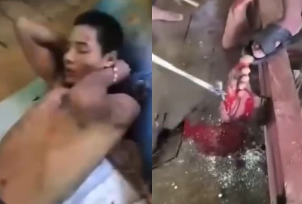 Captured Soldier Tortured By Rebels In Myanmar