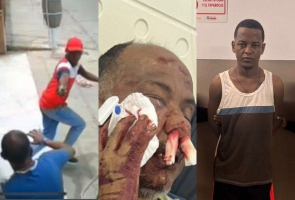 Elderly Man Shot In The Face During Robbery