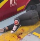 Girl with Nice Butt Gets Life Long Reminder to Pay Attention