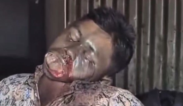 Local Party Leader Found Hung And Decomposing