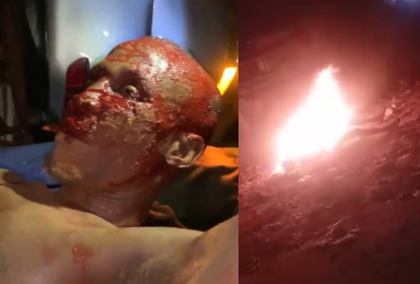 Barely Alive Thief Cursed Before Being Set Ablaze