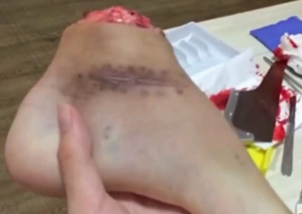 Vietnamese lunatic playing with amputed foot