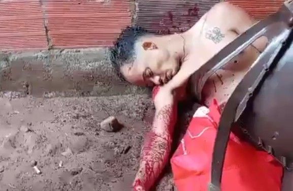 Aftermath Of Massacre In Colombia