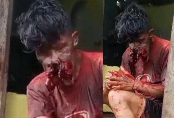 Dude Accidentally Shot Himself In Face While Playing With Firearm