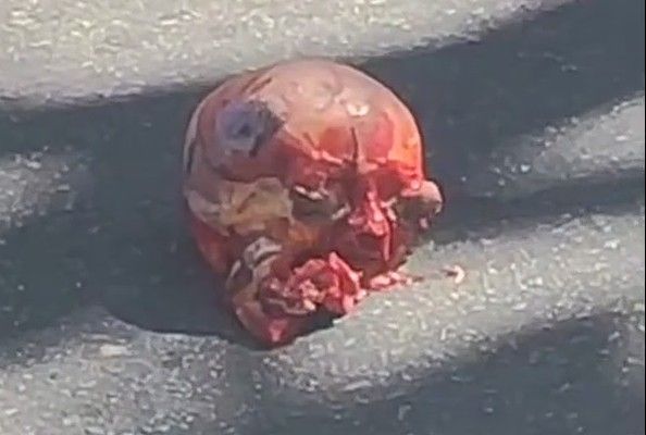 Damn : Woman's Skull Ejected Out Of Her Head