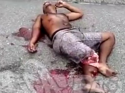 Legs crashed after a motorcycle accident 