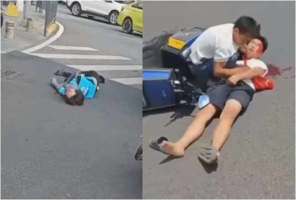 Moped Rider Suffers Seizure After A Fender Bender