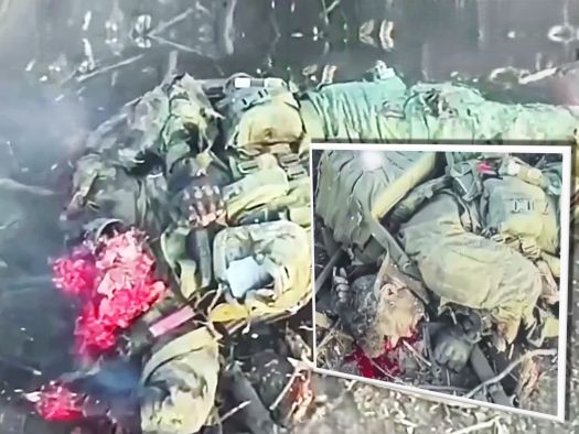 Lobotomizing Russians Is a Delicate Procedure