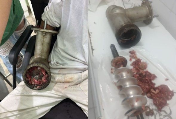 Meat Market Employee Lost Hand In Grinder (clean)