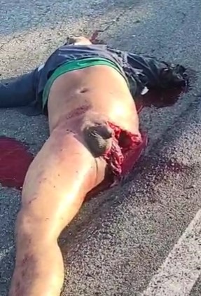 HORRIFIC , victim of shocking accident in brazil