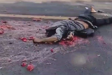 Tanker Truck Left Him With A Skull Cracked