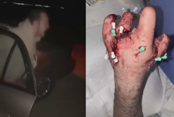 Bye Bye Fingers, Bye Bye