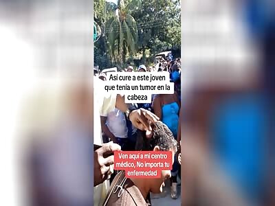 THE ONE DOLAR  TUMOR REMOVAL TREATMENT 