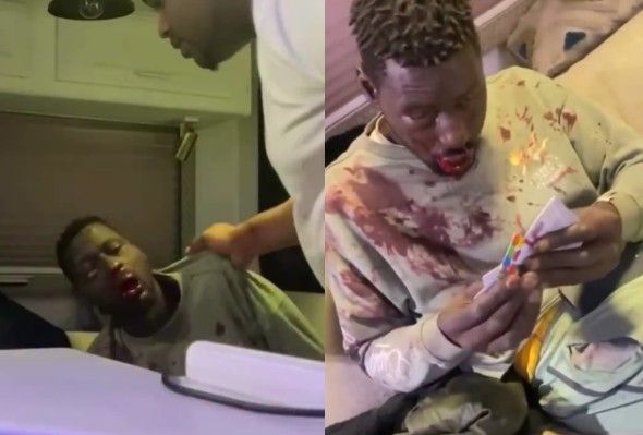 Man Gets Beaten To Bloody Pulp Over A Debt