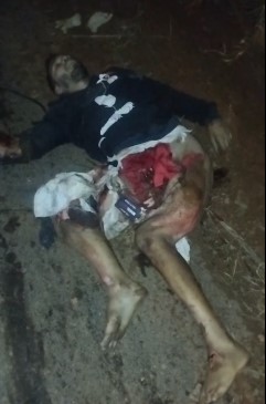 Brazilian man was spun by a truck