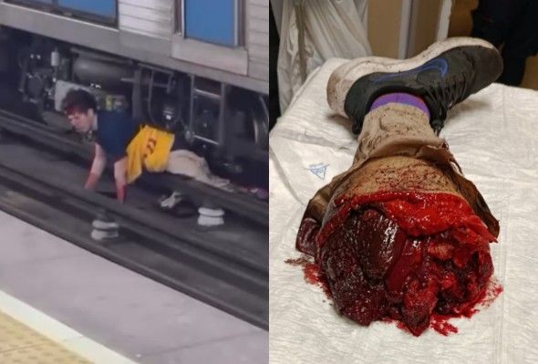 Man Fell On Tracks And Was Ripped By Train In Portugal