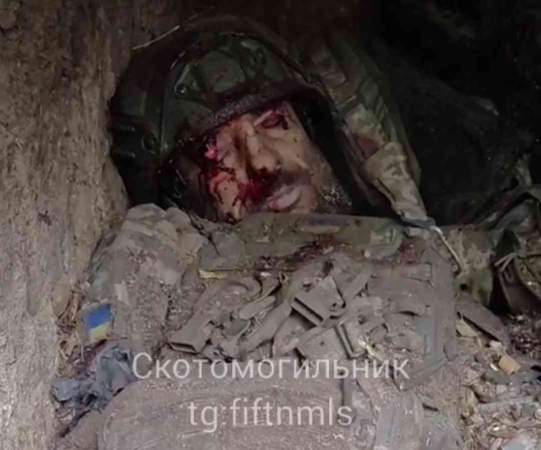 Ukrainian is resting. 